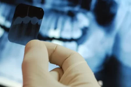 رادیولوژی و عکسبرداری دندان چیست؟